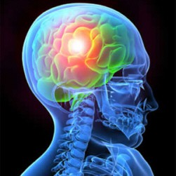 Socorro rápido em caso de AVC é fundamental para evitar morte e reduzir sequelas